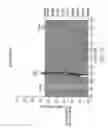Fig. 09 - Compact resilient anisotropic support for bearing