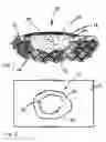 Fig. 02 - Method for repairing holes in pavement