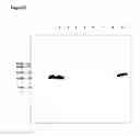 Fig. 33 - Hyperglycosylated polypeptide variants and methods of use