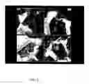 Fig. 03 - Replication competent virus or its recombinant for use in cancer therapy