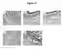 Fig. 17 - Cytotoxicity mediation of cells evidencing surface expression of CD63