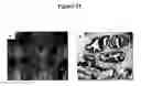 Fig. 23 - Cytotoxicity mediation of cells evidencing surface expression of CD63