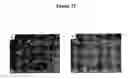 Fig. 24 - Cytotoxicity mediation of cells evidencing surface expression of CD63