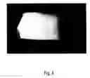 Fig. 05 - Crosslinked elastin and process for producing the same