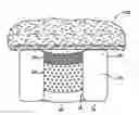 Fig. 01 - Methods and systems for delivering immunosuppressant and anti-inflammatory agents from a stent