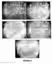 Fig. 07 - Thermosensitive polymers for therapeutic use and methods of preparation