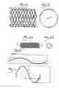 Fig. 02 - Cell-loaded prostheses for regenerative intraluminal applications