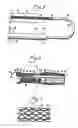 Fig. 03 - Cell-loaded prostheses for regenerative intraluminal applications