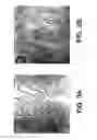 Fig. 07 - Liposome complexes for increased systemic delivery