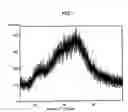 Fig. 02 - Solid dispersions or solid dispersion pharmaceutical preparations of phenylalanine derivatives