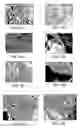 Fig. 03 - Method for treating a bone defect with an organic/inorganic composite