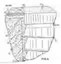 Fig. 06 - Method for manufacturing particles for use in forming a resorbable implant for stimulating bone growth