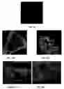 Fig. 13 - Method for manufacturing particles for use in forming a resorbable implant for stimulating bone growth