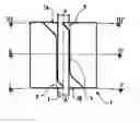 Fig. 01 - Orthodontic correction device