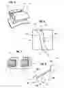 Fig. 02 - Orthodontic correction device
