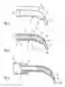 Fig. 02 - Cartridge for storing and applying a mass
