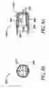 Fig. 13 - Dental implant system
