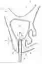 Fig. 01 - Dental implant system and method