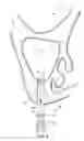 Fig. 06 - Dental implant system and method