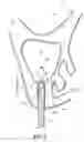 Fig. 07 - Dental implant system and method
