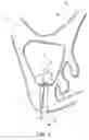 Fig. 08 - Dental implant system and method