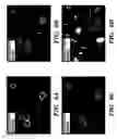 Fig. 08 - Platelet biomarkers for the detection of disease