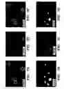 Fig. 09 - Platelet biomarkers for the detection of disease