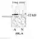 Fig. 08 - Methods for diagnosing htlv-i-mediated diseases