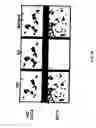 Fig. 03 - Method to diagnose and evaluate progression of Alzheimer's disease