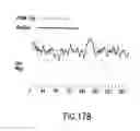 Fig. 375 - Novel genes encoding proteins having prognostic, diagnostic, preventive, therapeutic, and other uses