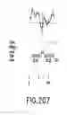 Fig. 441 - Novel genes encoding proteins having prognostic, diagnostic, preventive, therapeutic, and other uses