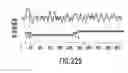Fig. 474 - Novel genes encoding proteins having prognostic, diagnostic, preventive, therapeutic, and other uses