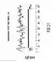 Fig. 52 - Novel genes encoding proteins having prognostic, diagnostic, preventive, therapeutic, and other uses