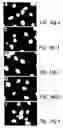 Fig. 18 - Nucleic acid encoding an interleukin-9 receptor variant