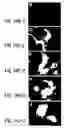 Fig. 21 - Nucleic acid encoding an interleukin-9 receptor variant