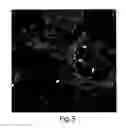 Fig. 06 - Enriched pancreatic stem cell and progenitor cell populations, and methods for identifying, isolating and enriching for such populations