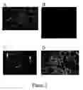 Fig. 02 - Neural progenitor cells derived from whole bone marrow