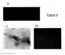 Fig. 06 - Neural progenitor cells derived from whole bone marrow