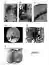 Fig. 12 - Neural progenitor cells derived from whole bone marrow