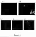 Fig. 15 - Neural progenitor cells derived from whole bone marrow