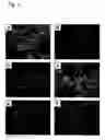 Fig. 04 - In vitro differentiation and maturation of mouse embryonic stem cells into hepatocytes