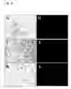 Fig. 05 - In vitro differentiation and maturation of mouse embryonic stem cells into hepatocytes