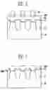 Fig. 03 - Method of forming floating gate electrode in flash memory device