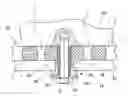 Fig. 01 - Mount for equipment for conveying persons