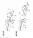 Fig. 05 - Method for forming a terminal metal and terminal metal formed by the method
