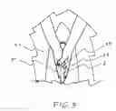 Fig. 06 - Pendulum putting system