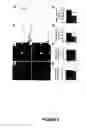 Fig. 07 - Methods of treating neurological diseases by regulating migration of neuroblasts in the adult nervous system with tenascin-R