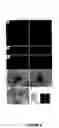 Fig. 09 - Methods of treating neurological diseases by regulating migration of neuroblasts in the adult nervous system with tenascin-R