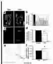 Fig. 13 - Methods of treating neurological diseases by regulating migration of neuroblasts in the adult nervous system with tenascin-R