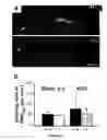 Fig. 14 - Methods of treating neurological diseases by regulating migration of neuroblasts in the adult nervous system with tenascin-R